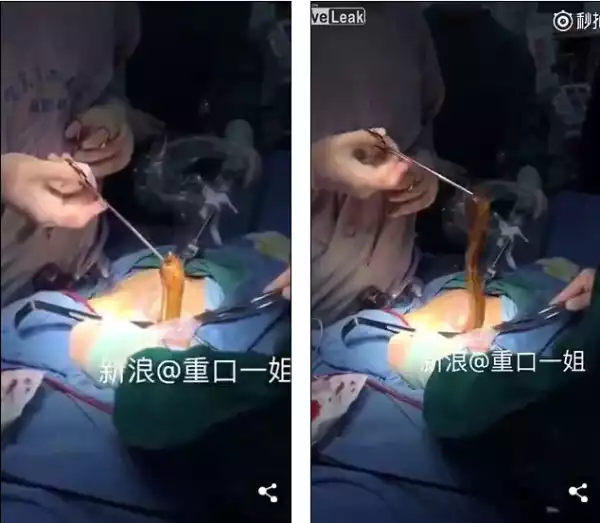 See The Type Of Fish Doctors Removed From A Patient